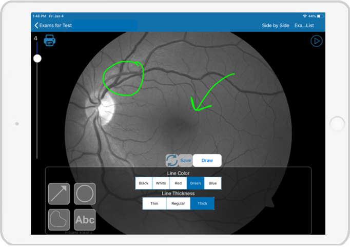 Image of an eye scan