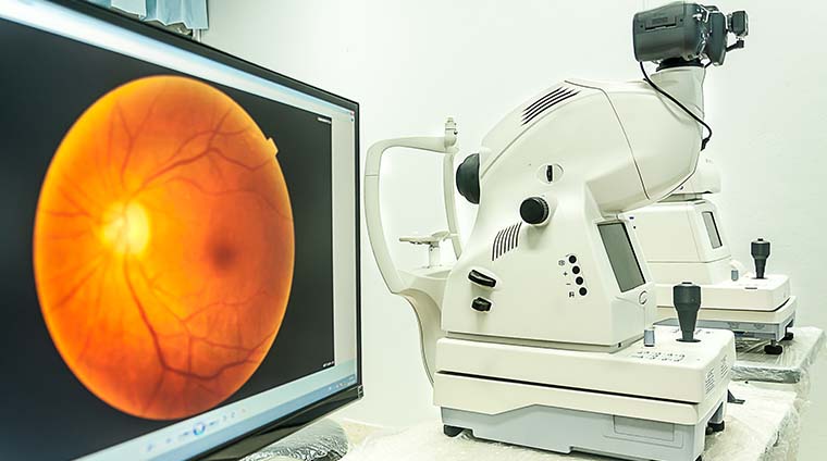 Optometry EHR diagnostic equipment with retinal image displayed on monitor